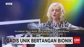 VIDEO: Tilly Locky, Gadis Inggris Bertangan Bionik