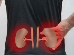 Ini Alasan Kanker Ginjal Seperti yang Diderita Vidi Aldiano Sulit Terdeteksi