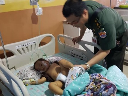 Bayi 15 Bulan Hampir Lumpuh Gara-gara Dicium Paksa