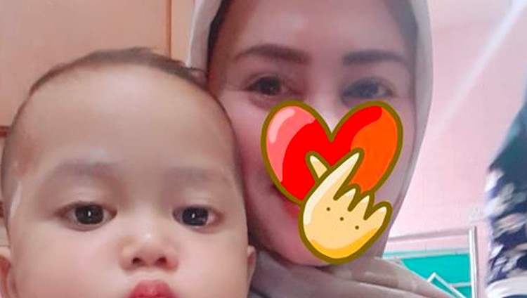  Ibu Bayi  Hampir Lumpuh karena Dicium Peringatkan soal 