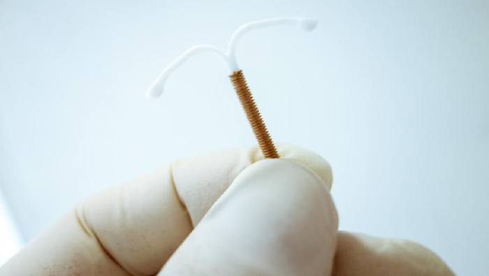 IUD (Intrauterine Device) Birth Control