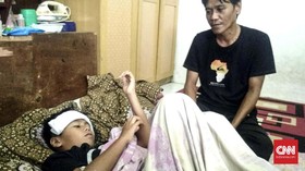 Lemas Tak Bersuara Bocah di Depok usai Dipatuk Anak Kobra