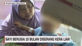 VIDEO: Teror Serangan Kera, Bayi 10 Bulan Terluka
