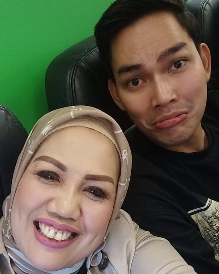 6 Potret Penampilan Baru Ely Sugigi Usai Potong Gigi Di penghujung tahun 2019, Ely Sugigi memutuskan untuk mengubah penampilannya. Ia mengubah bentuk giginya dengan melakukan perawatan potong gigi.