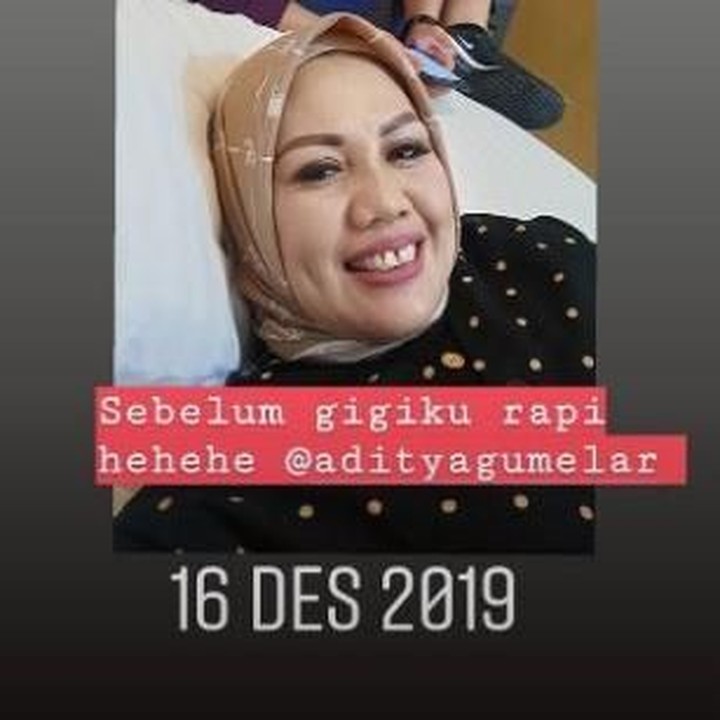<p>Elly sempat berfoto sebelum menjalani prosedur potong gigi. Kemudian, ia mengunggahnya di Instagram Story. (Foto: Instagram @ellysugigi_real_)</p>