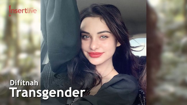 Dibully di Medsos, Nora Alexandra Banjir Dukungan dari Netizen