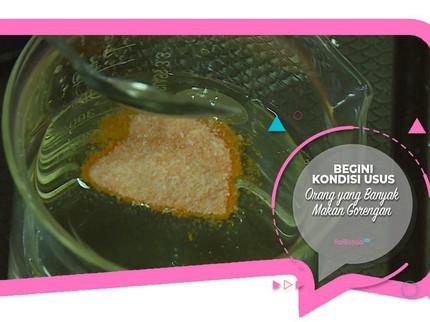 Begini Kondisi Usus Orang yang Banyak Makan Gorengan