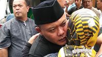 Ditemukan Lebam di Tubuh Lina Eks Sule, Bisakah Terjadi Setelah Kematian?