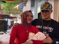 Dokter Forensik Sebut Lebam pada Jenazah Lina eks Sule Wajar