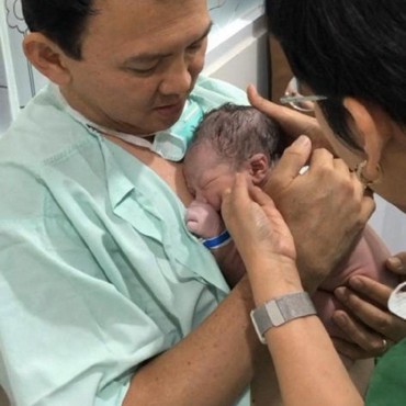 Ahok Skin to Skin dengan Sang Bayi, Yosafat Abimanyu Purnama