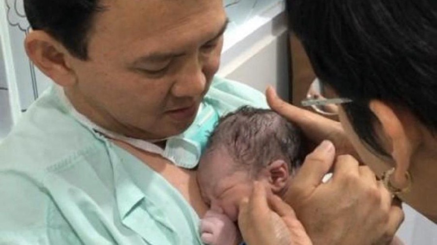 Momen ketika Ahok lakukan skin to skin contact dengan putranya, Yosafat Abimayu Purnama.
