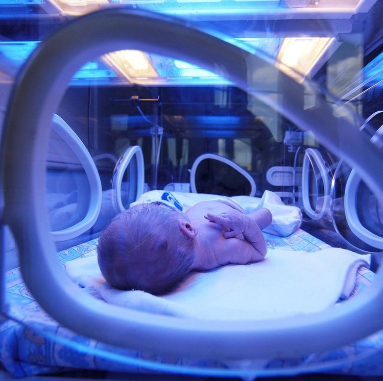 Newborn child baby having a treatment for jaundice under ultraviolet light in incubator. A neonatal intensive care unit (NICU), intensive care nursery (ICN) for premature newborn infants