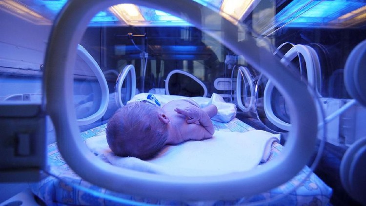 Newborn child baby having a treatment for jaundice under ultraviolet light in incubator. A neonatal intensive care unit (NICU), intensive care nursery (ICN) for premature newborn infants