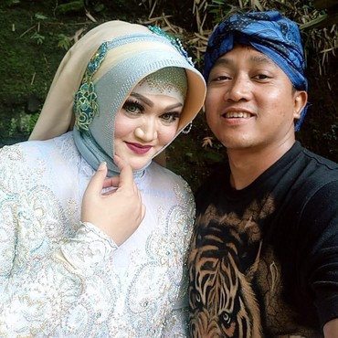 Soal Lebam di Mulut & Dagu Lina, Ini Penjelasan Rumah Sakit