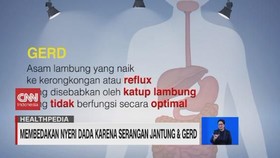 VIDEO: Membedakan Nyeri Dada Karena Serangan Jantung & Gerd