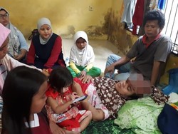 Derita Sri Rahayu Warga Pekanbaru Idap Kanker Ganas di Kepala