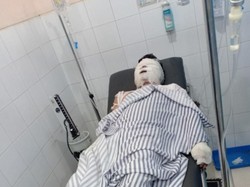 Janjian Indehoi di Hotel, Pemuda di Karawang Dibakar-Dirampok