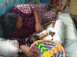Meilani Alfira Balita Usia 2,8 Tahun Penderita Gizi Buruk Tubuhnya Sangat Kurus