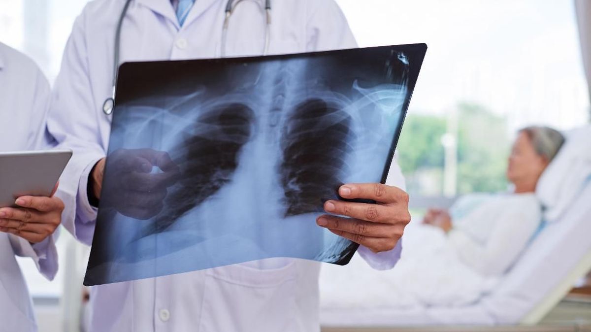Pneumonia Bisa Berujung Kematian, Vaksinasi Jadi Pencegahan Utama