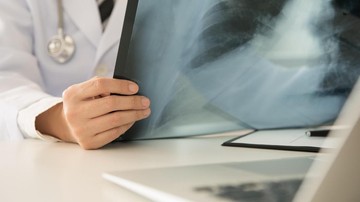 IDAI Sebut Campak Bisa Sebabkan Pneumonia hingga Radang Otak