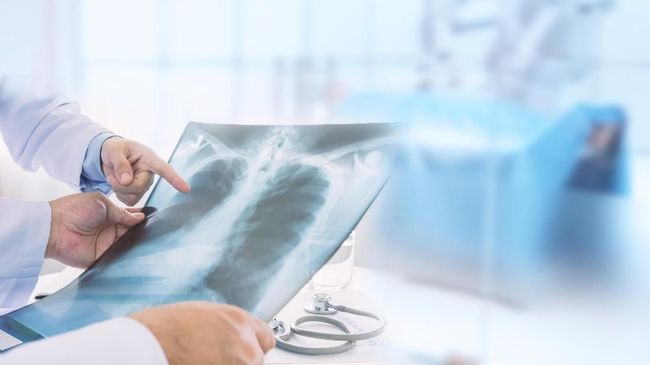 Mycoplasma pneumoniae merupakan salah satu penyebab kenaikan kasus pneumonia di China. Berikut beberapa fakta tentang Mycoplasma pneumonia.