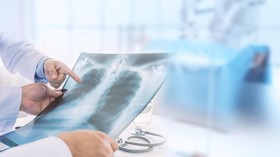 Ahli soal RS DKI Penuh Pasien Pneumonia: Jadikan Alarm Lonjakan Covid