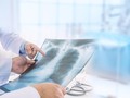 Thailand Temukan Kasus Kedua Pneumonia Misterius dari China