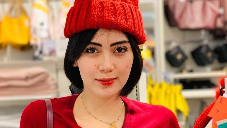 Arfita Dwi Putri, istri Yama Carlos