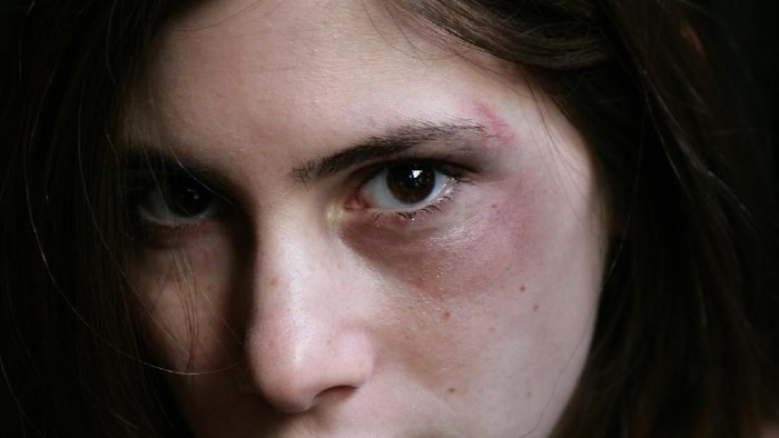 Abused woman begging for help