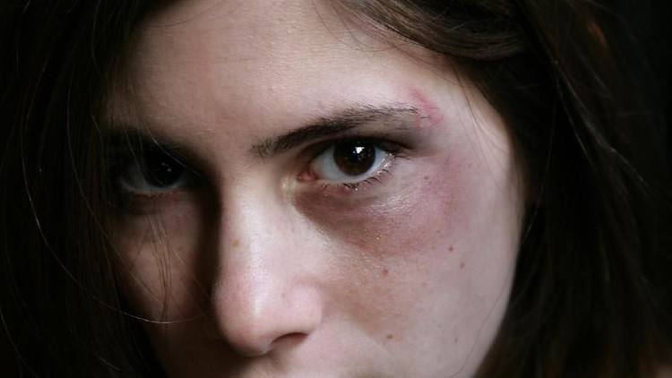 Abused woman begging for help