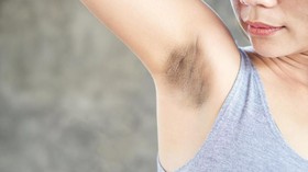 5 Cara Mencerahkan Kulit Ketiak