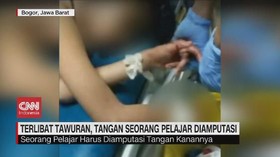 VIDEO: Tawuran, Tangan Seorang Pelajar Harus Diamputasi