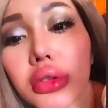 Filler Bibir Tebal,  Lucinta Luna: Gue Kylie Jenner Indonesia