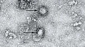 Virus Kuno 15 Ribu Tahun di Gletser Tibet, 28 Tak Dikenali
