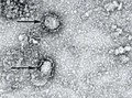 Studi Temukan Kelemahan Virus Corona