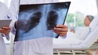 Apa Itu Pneumonia? Begini Penjelasannya