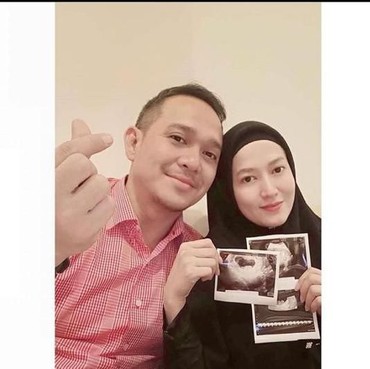 Ungkap Usia Kandungan, Fadlan & Lyra Virna Pamer Foto Hasil USG