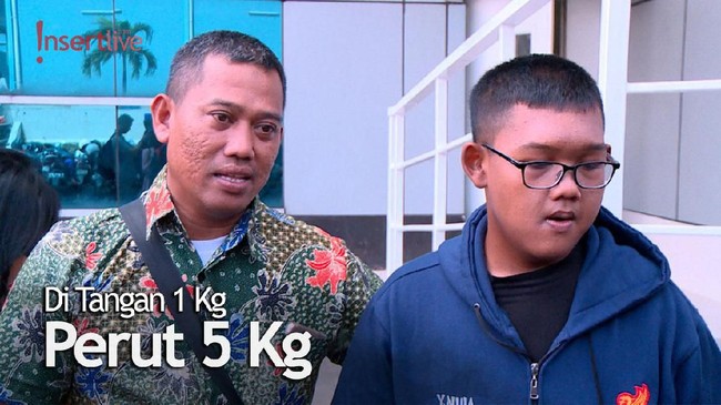 Turut Berat Badan 110 kg, Arya Permana Operasi Kulit Gelambir