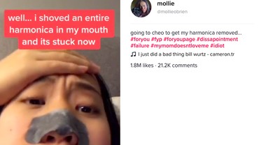 img-title Kasihan, Mulut Cewek Ini Tersangkut Harmonika Gegara TikTok
