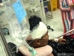 Anak Petinggi PP Sukabumi Jadi Korban Kebrutalan Gerombolan Bermotor