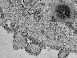 1 Lagi Meninggal Akibat Virus Corona di Iran, Total Korban Jiwa 3 Orang
