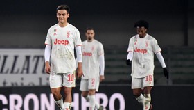 Ancelotti Kesal Kelalaian Bek Everton hingga Juventus Kalah