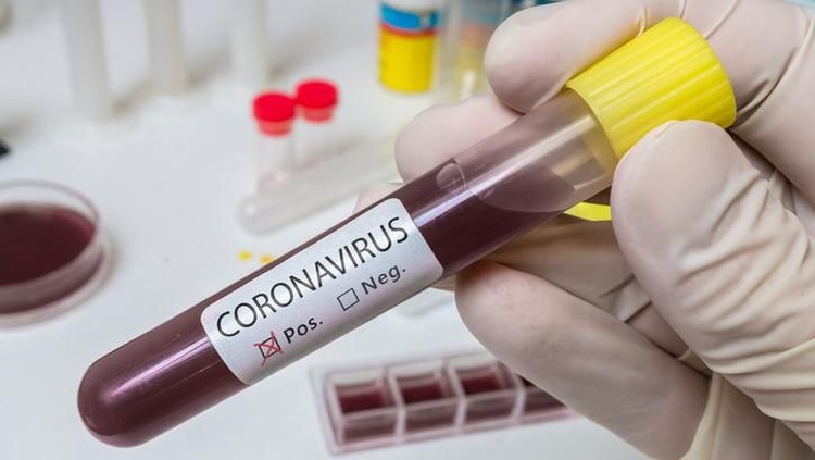 Salah satu cara mencegah penularan virus Corona pada anak adalah melakukan imunisasi lengkap. Cara ini bisa membantu menjaga imunitas tubuh bayi.