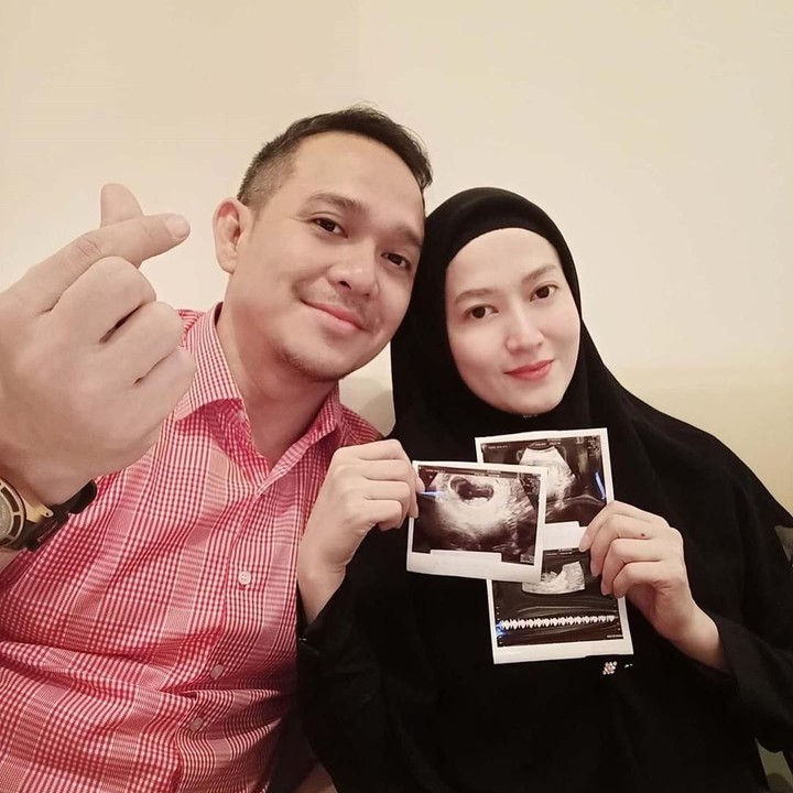 <p><strong>6. Lyra Virna</strong>   Lyra Virna kini tengah mengandung anak dari pernikahannya dengan Fadlan Muhammad. Ini adalah anak pertamanya setelah 7 tahun menikah dengan fadlan (Foto: Instagram/@fadlanmuhammad)  </p>