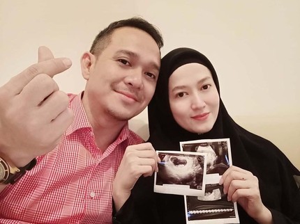 7 Deretan Seleb yang Hamil dan Akan Melahirkan di 2020