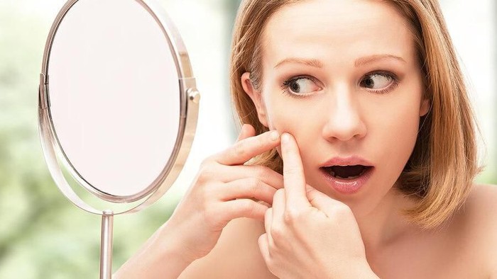Cara Mengenali & Mengatasi Jerawat Hormonal