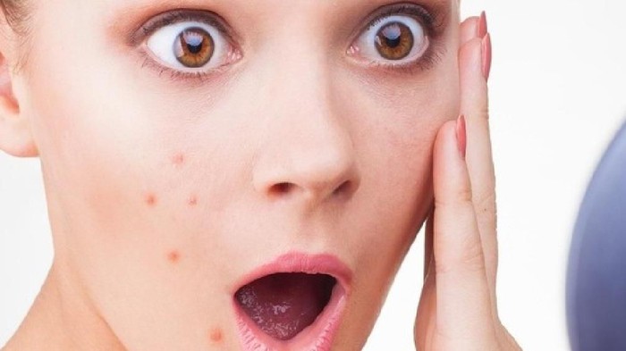 5 Makanan Pencegah Timbulnya Jerawat