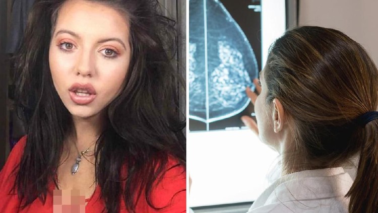 Seorang perempuan asal Inggris memiliki empat payudara, Bunda. Hal ini membuatnya hilang rasa percaya diri bahkan ingin bunuh diri. Simak kisah lengkapnya.