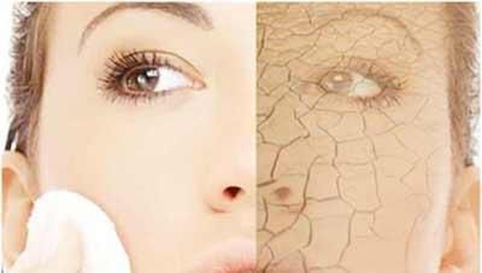 Tips Perawatan untuk Kulit Kering