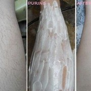 Cara Menghilangkan Bulu Kaki Dengan Krim